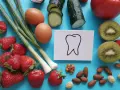 Dieta z aparatem na zęby: Co jeść, by leczyć zęby bez obaw?