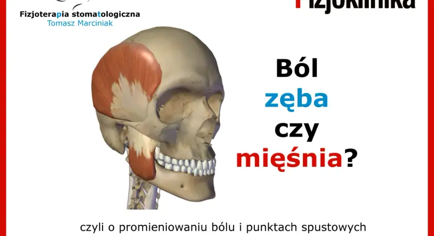 Model czaszki z zaznaczonym mięśniem żwaczem, obok tekst: "Ból zęba czy mięśnia?".