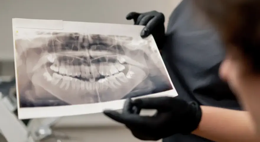Pantomogram: Co dentysta widzi na zdjęciu? Ukryte problemy jamy ustnej