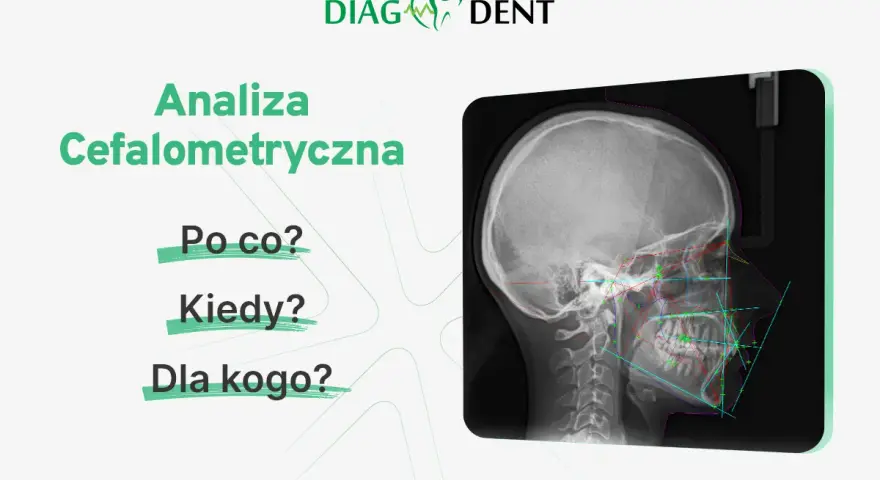 Analiza cefalometryczna: zdjęcie RTG czaszki z naniesionymi liniami i kątami. Pytania: Po co? Kiedy? Dla kogo?