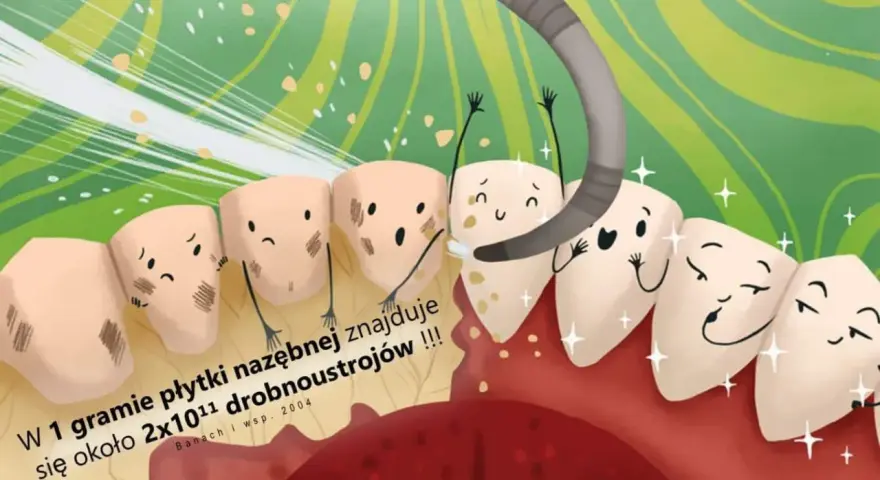 Piaskowanie zębów: Odzyskaj naturalny blask i gładkość. Poradnik