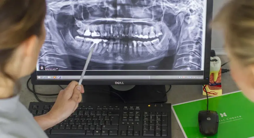 Górna dwójka: Jeden kanał to norma? Sprawdź, co mówi dentysta