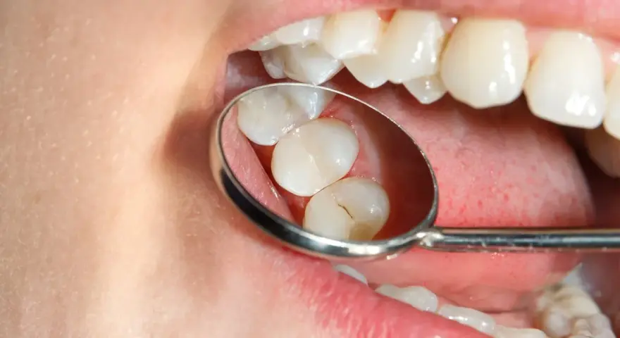 Znieczulenie u dentysty: czy jest bezpieczne? Fakty i mity