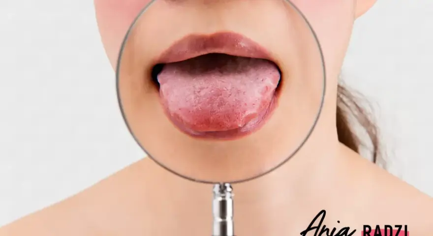 Powiększony pypeć na języku pod lupą.