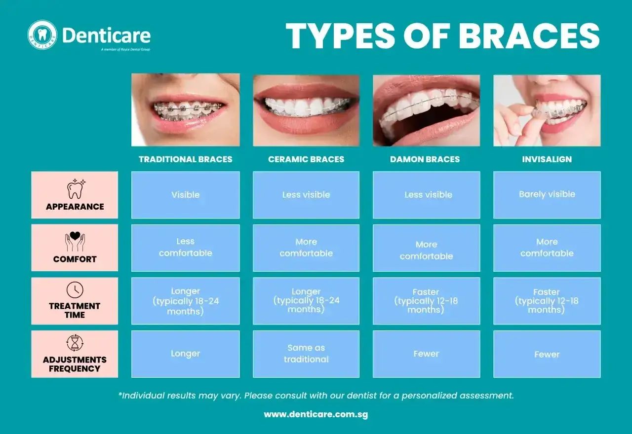 Porównanie aparatów ortodontycznych: tradycyjnych, ceramicznych, Damon i Invisalign. Wybierz swój aparat estetyczny.