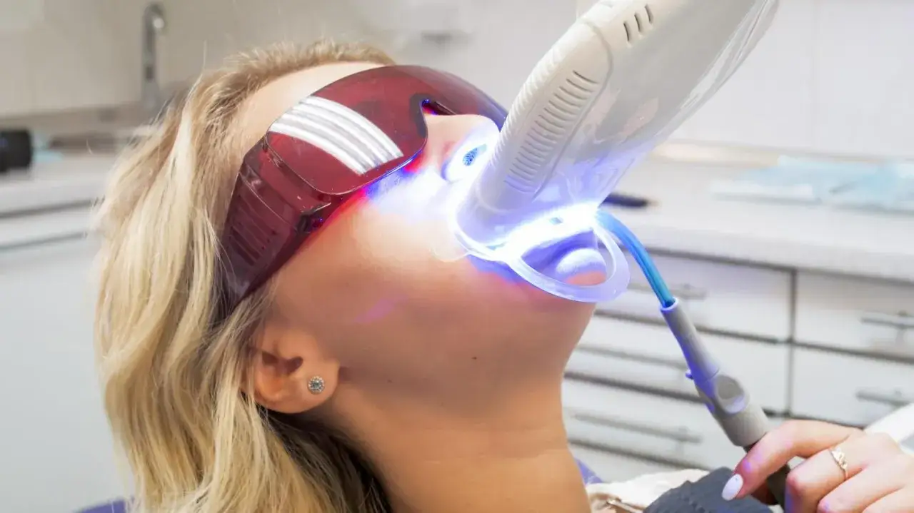 różne metody wybielania zębów lampa nakładki laser